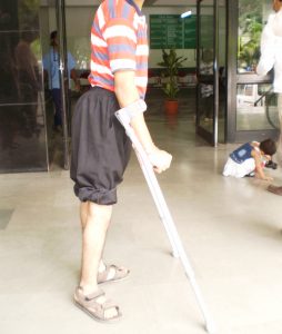 Knee Flexion Deformity After